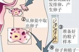 马来西亚试管婴儿的真实费用：做一次治疗大概要多少钱？